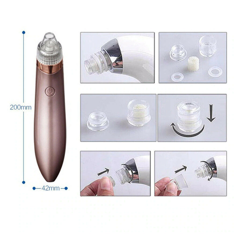 Electric Blackhead Vacuum Pore Cleaner Acne Pimple Remover Strong Suction Tools.