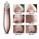 Electric Blackhead Vacuum Pore Cleaner Acne Pimple Remover Strong Suction Tools.