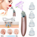 Electric Blackhead Vacuum Pore Cleaner Acne Pimple Remover Strong Suction Tools.