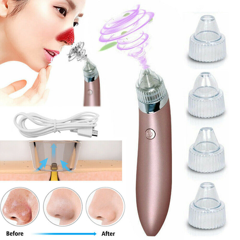 Electric Blackhead Vacuum Pore Cleaner Acne Pimple Remover Strong Suction Tools.